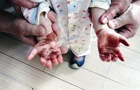 孕妇灭蚊小妙招_灭蚊子 孕妇_孕妇灭蚊