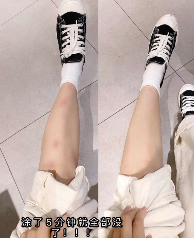 灭蚊子 孕妇_孕妇灭蚊小妙招_孕妇灭蚊
