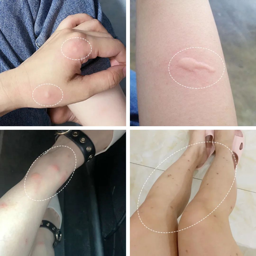 灭苍蝇的灯是紫外线吗_灭苍蝇的灯_灭苍蝇灯有用吗