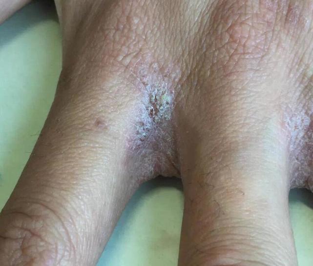 灭臭虫多少钱_灭杀臭虫_臭虫用什么药灭绝