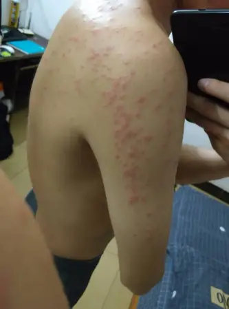 如何灭臭虫_灭臭虫公司费用_怎样有效杀灭臭虫