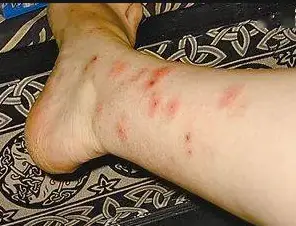 灭臭虫公司费用_怎样有效杀灭臭虫_如何灭臭虫
