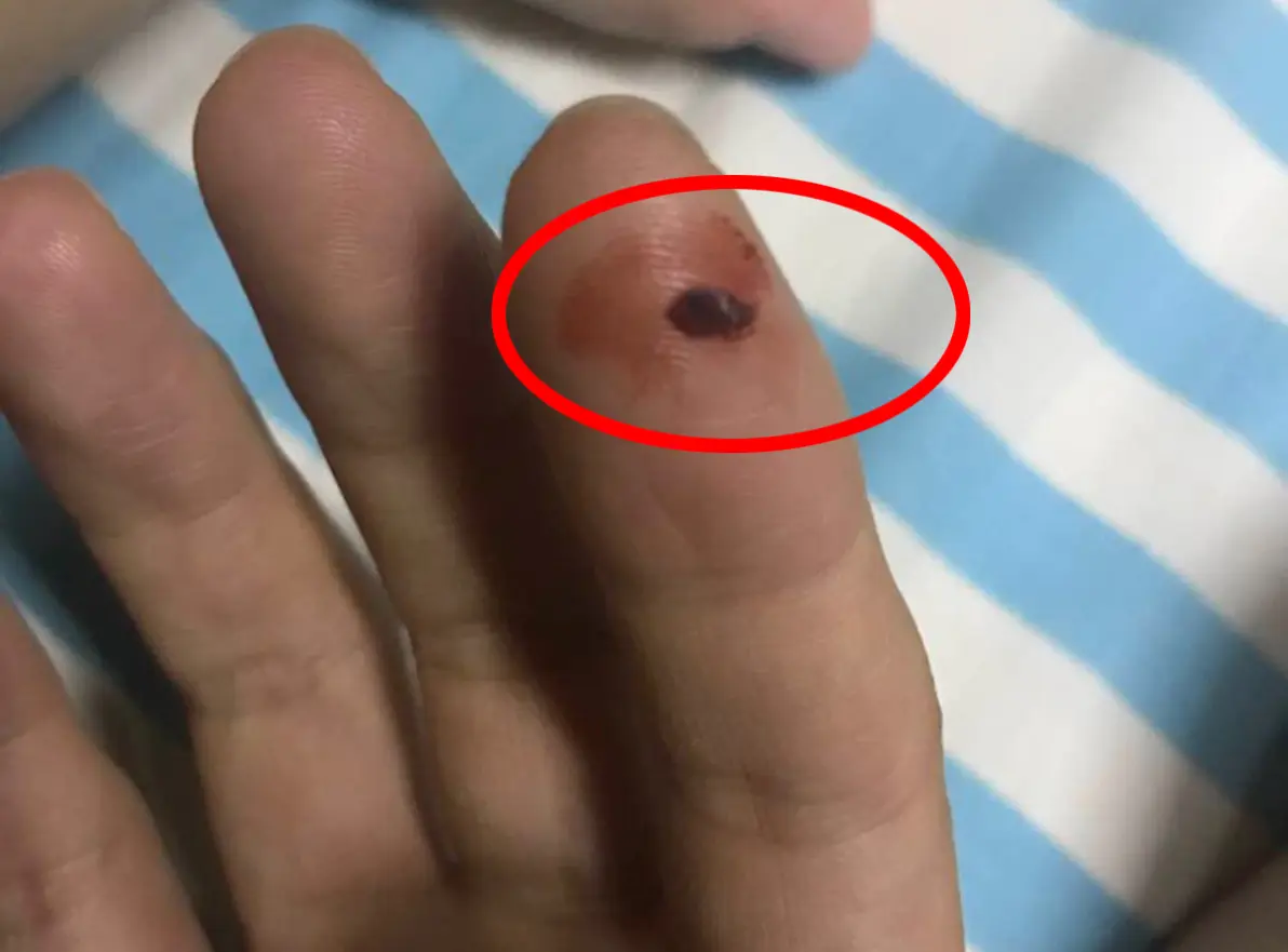 灭臭虫用什么药_灭臭虫的用品_灭臭虫神器